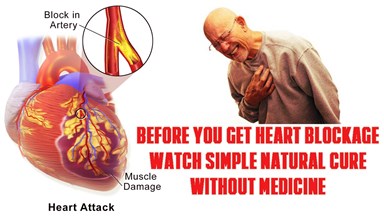 11 Nutrients and 14 Natural Foods that avoid or reverse heart blockages